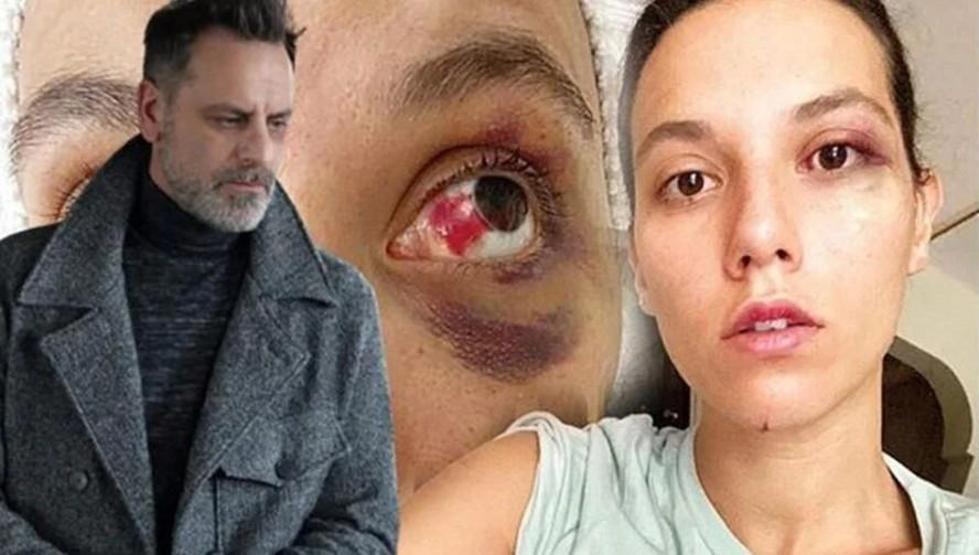 Deniz Bulutsuz’dan Çarpıcı Paylaşım: Cezaevine Gireceği Günü Bekliyorum