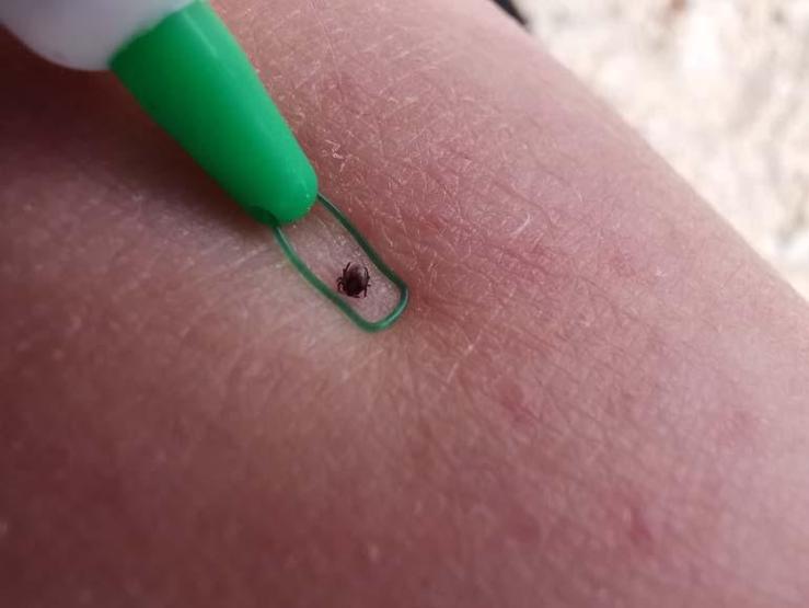 Sessiz Tehlike Pusuda Grip Gibi Başlıyor, İç Kanamaya Kadar Götürüyor