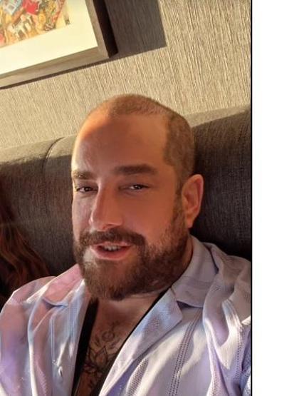 Enis Arıkanın saçsız hali gündem oldu Meğer protez saç kullanıyormuş