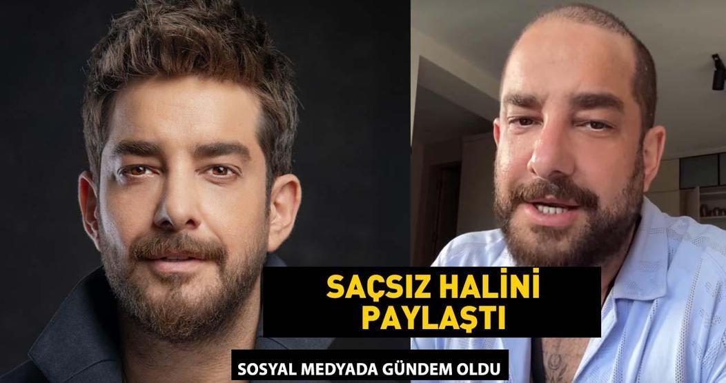 Enis Arıkanın saçsız hali gündem oldu Meğer protez saç kullanıyormuş