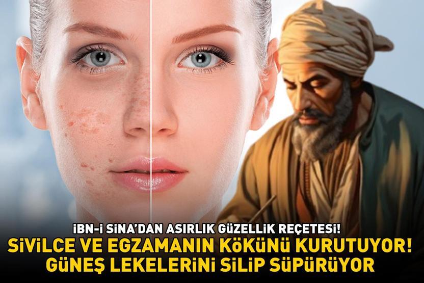 İbn-i Sinadan asırlık güzellik reçetesi Güneş lekelerini silip süpürüyor, sivilce ve egzamanın kökünü kurutuyor