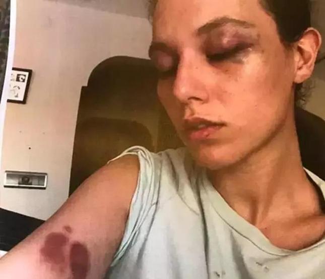 Deniz Bulutsuz Cezaevine gireceği günü bekliyorum demişti Ozan Güven, o sözler sorulunca bakın ne yanıt verdi