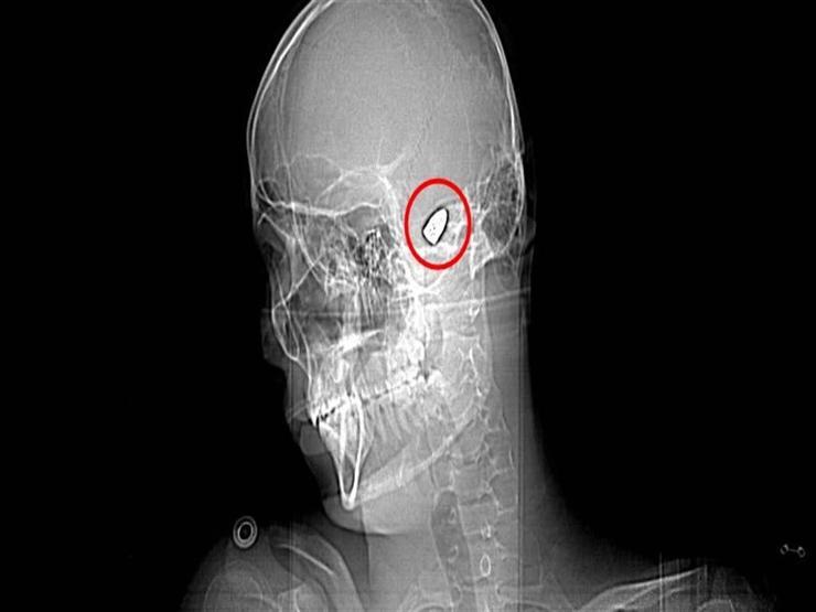 Çoğu Zaman Fark Edilmiyor, Tesadüfen Bulunuyor Uzman İsimden Hayati Uyarı: Silah Sesi Duyduğunuzda Balkona Pencereye Koşmayın