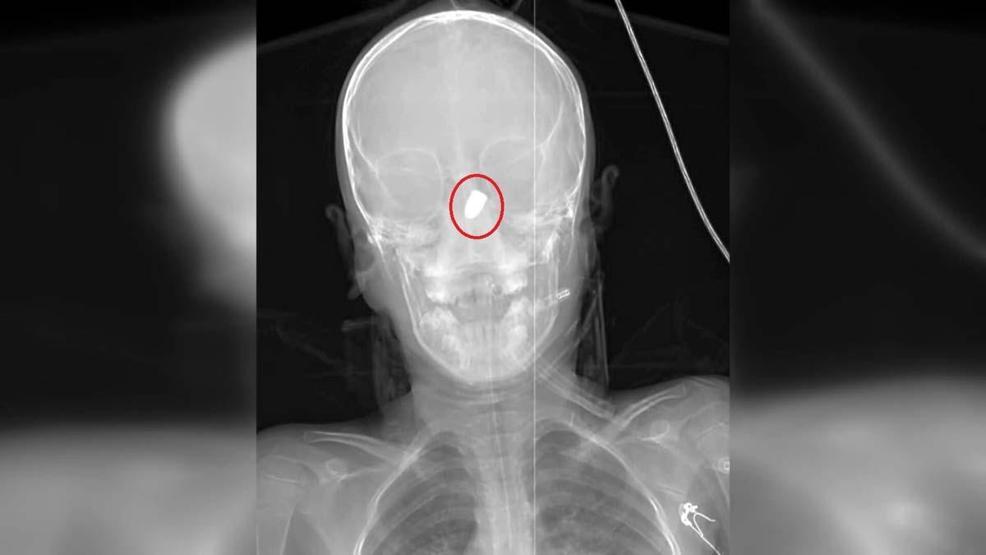 Çoğu Zaman Fark Edilmiyor, Tesadüfen Bulunuyor Uzman İsimden Hayati Uyarı: Silah Sesi Duyduğunuzda Balkona Pencereye Koşmayın
