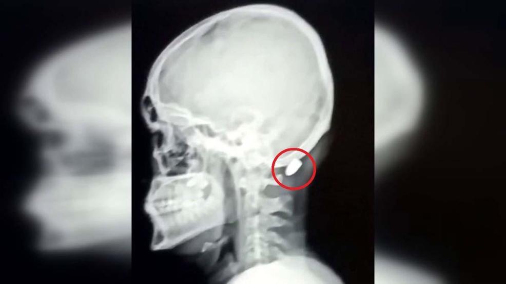 Çoğu Zaman Fark Edilmiyor, Tesadüfen Bulunuyor Uzman İsimden Hayati Uyarı: Silah Sesi Duyduğunuzda Balkona Pencereye Koşmayın