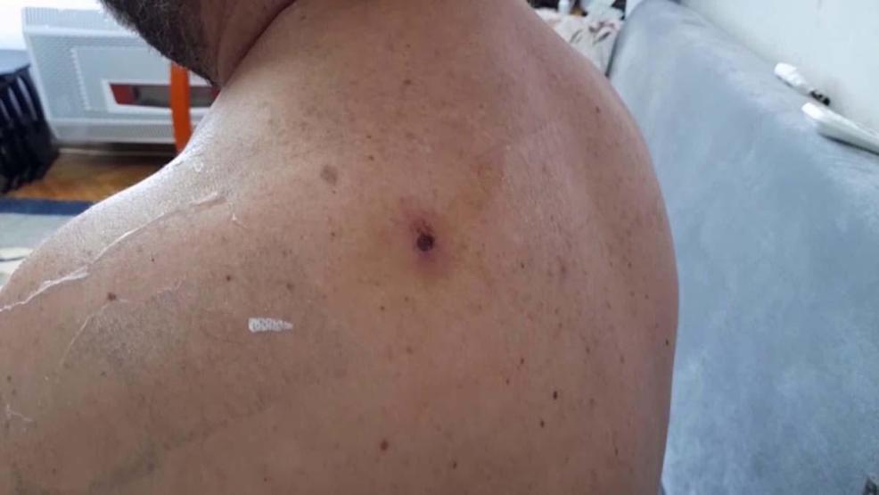 Çoğu Zaman Fark Edilmiyor, Tesadüfen Bulunuyor Uzman İsimden Hayati Uyarı: Silah Sesi Duyduğunuzda Balkona Pencereye Koşmayın