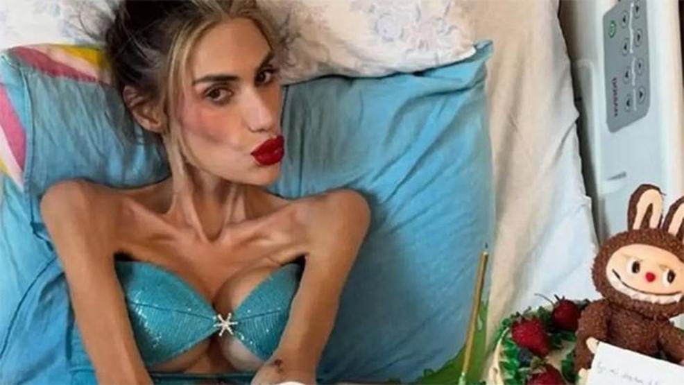Ölümüne Zayıf Olma Hastalığı: 7 MADDEDE ANOREKSİYA NEVROZA Nihal Candan 23 Kiloya Düştü Hastanede Olmasına Rağmen Neden Hala Zayıflıyor