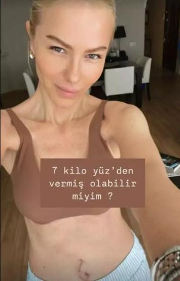 Seçil Gür, Sağlık Sorunları Nedeniyle 9 Kilo Verdiğini Açıkladı