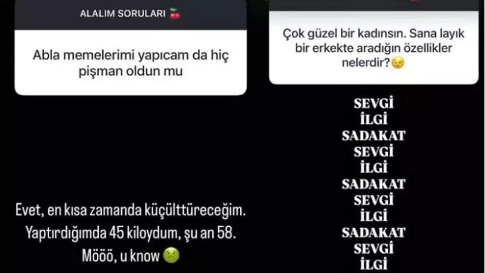 İrem Dericinin Estetik İtirafı: Yakında Büyük Bir Değişim Geliyor