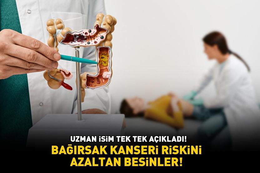 Uzman isim tek tek açıkladı BAĞIRSAK KANSERİ RİSKİNİ AZALTAN BESİNLER