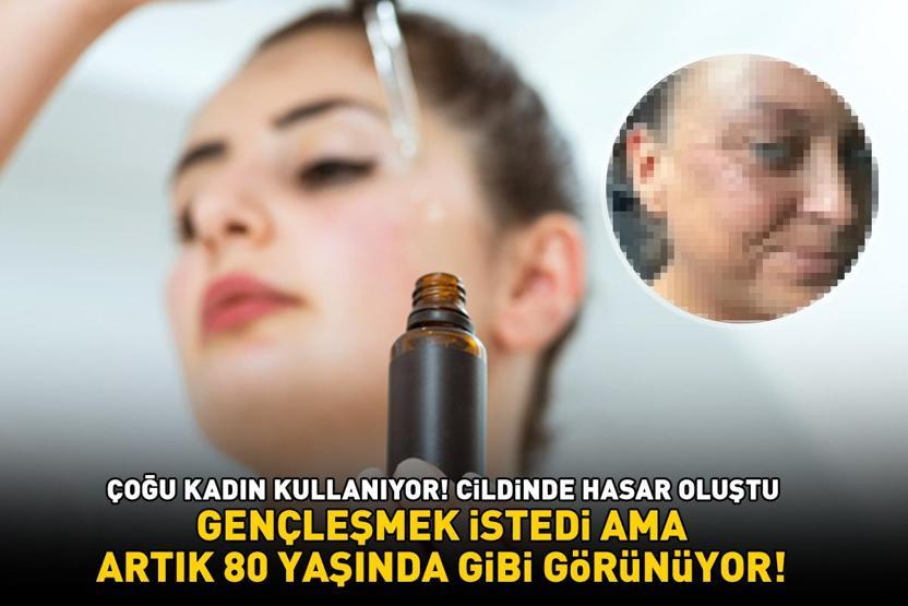 CİLDİNDE HASAR OLUŞTU Çoğu kadın kullanıyor Gençleşmek istedi ama artık 80 yaşında gibi görüyor