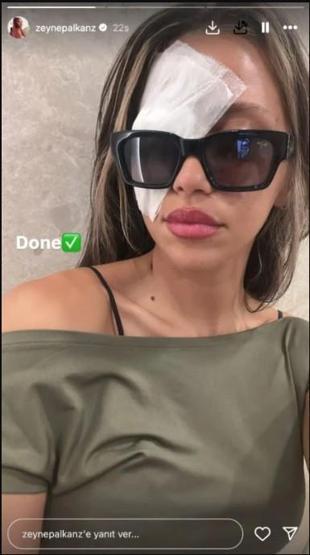 Zeynep Alkandan Korkutan Haber Göz Ameliyatı Geçirdi