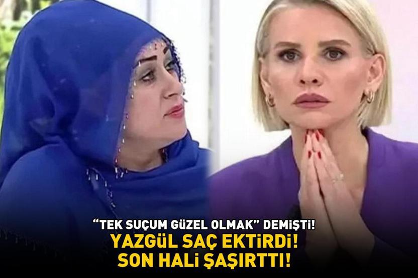 Esra Erolda Tek suçum güzel olmak demişti Saç ektiren Yazgülün son hali şaşırttı