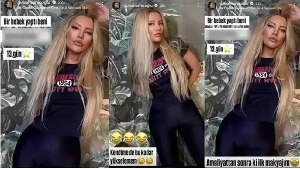 Gülşah Saraçoğlu’nun Estetik Değişimi Ortaya Çıktı Deniz Sekinin Doğum Gününde Yeni Hali Gündeme Geldi
