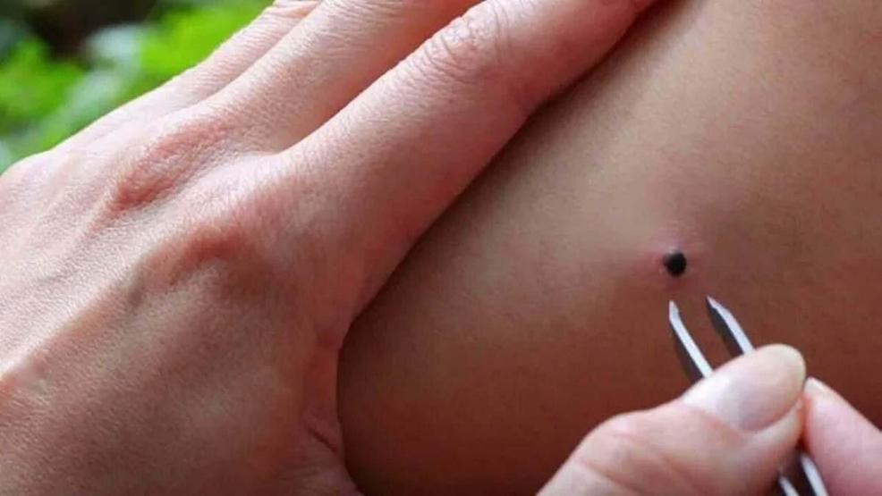 İstanbuldan Sonra Şimdi de İzmirde Kene Alarmı