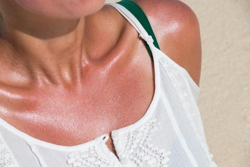 Tatile çıkacaklar dikkat SAĞLIKLI VE KALICI BRONZLUK İÇİN 8 TÜYO