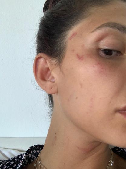 Can Yaman’ın büyük aşkı Sara Bluma kanlar içinde Ünlü oyuncu, şiddet gören sevgilisine böyle destek verdi: YANINDAYIM