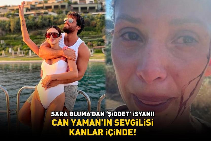 Can Yaman’ın büyük aşkı Sara Bluma kanlar içinde Ünlü oyuncu, şiddet gören sevgilisine böyle destek verdi: YANINDAYIM