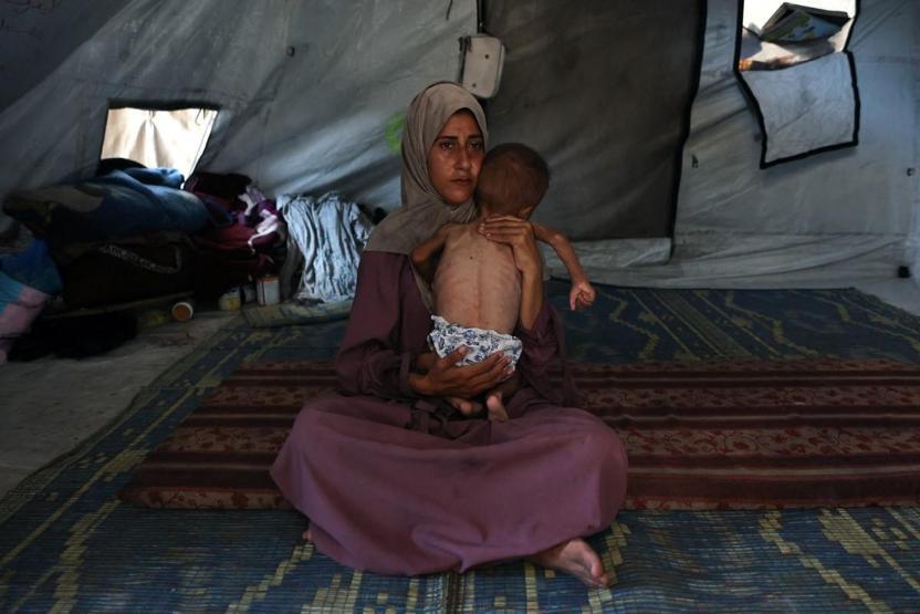 İsrail Ablukası Altındaki Gazze’de Açlıktan Ölümler Artıyor: Son 24 Saatte 14 Filistinli Daha Hayatını Kaybetti