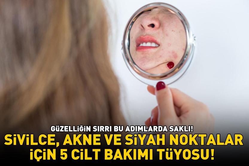 GÜZELLİĞİN SIRRI BU ADIMLARDA SAKLI Sivilce, akne ve siyah noktalar için 5 cilt bakımı tüyosu