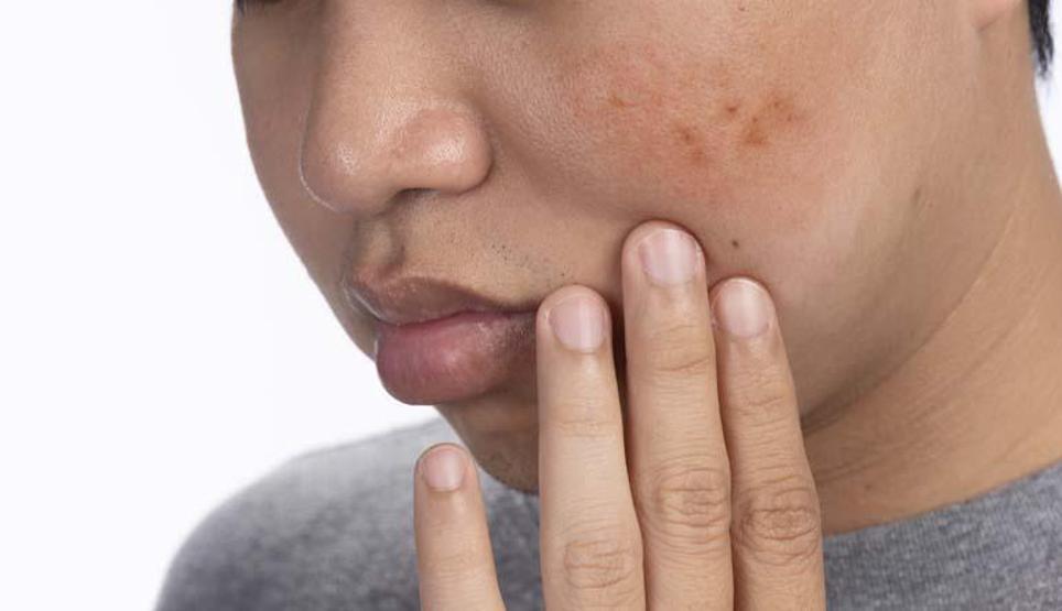 2 Haftada 5 Ciddi Vaka İnternetten Satılan Sahte Kremler Tehlike Saçıyor