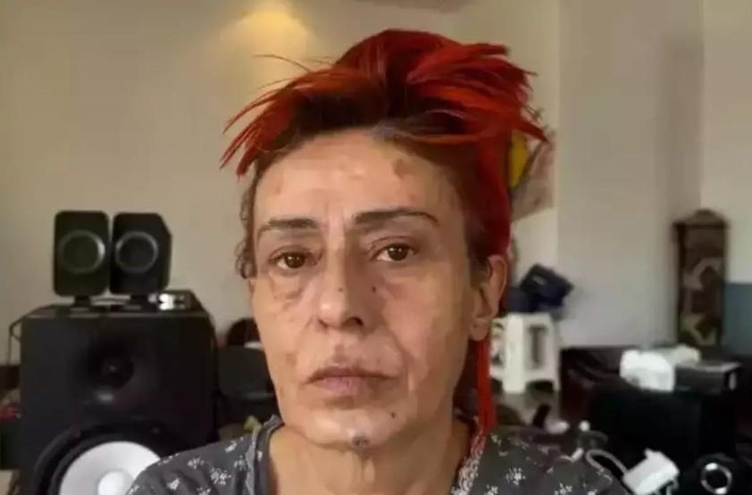 Yıldız Tilbeden Çarpıcı Açıklama: “Bazılarının Dikenleri Vardır; Benim Gibi”