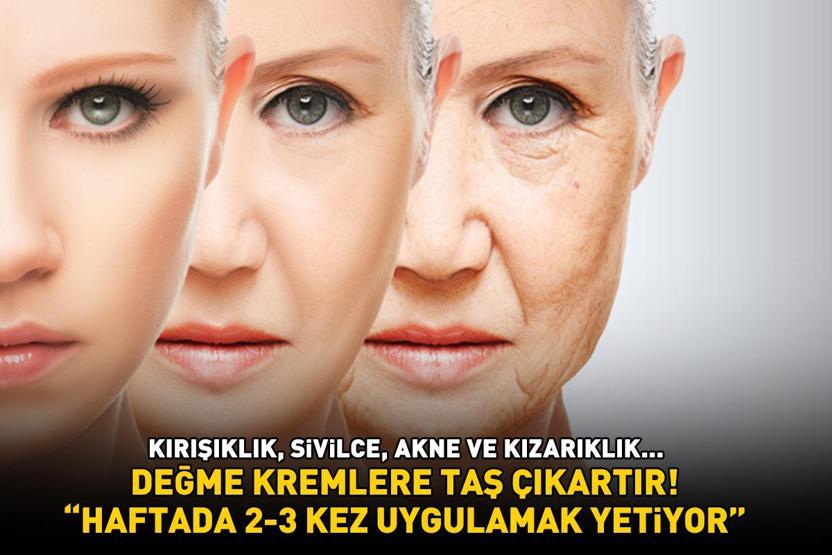 KIRIŞIKLIK, SİVİLCE, AKNE VE KIZARIKLIK... Değme kremlere taş çıkartan yöntem: Haftada 2-3 kez uygulamak yetiyor