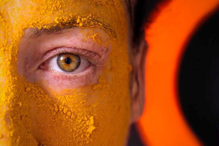 KIRIŞIKLIK, SİVİLCE, AKNE VE KIZARIKLIK... Değme kremlere taş çıkartan yöntem: Haftada 2-3 kez uygulamak yetiyor