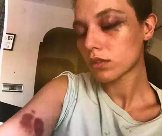 7 Kocalı Hürmüz Müzikalinin kadrosundan ayrılmıştı Ozan Güven sessizliğini bozdu