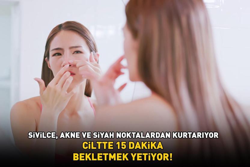 Sivilce, akne ve siyah noktaların kökünü kurutan 3 doğal yöntem Ciltte 15 dakika bekletmek yetiyor
