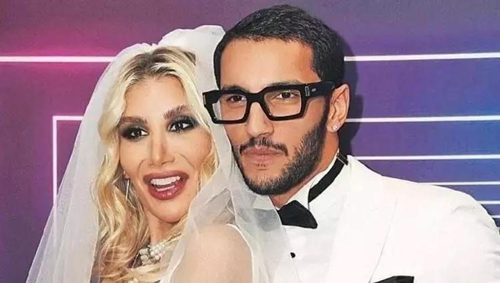 İrem Derici Kafasındaki 40 Dikişle Sahnede Kafam Kemiğime Kadar Açıldı