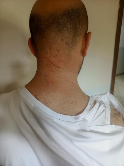 Velayet davasına kan bulaştı Çocuğunu görmeye giden babaya kadınlardan sopalı saldırı: İmdat diye kaçtı