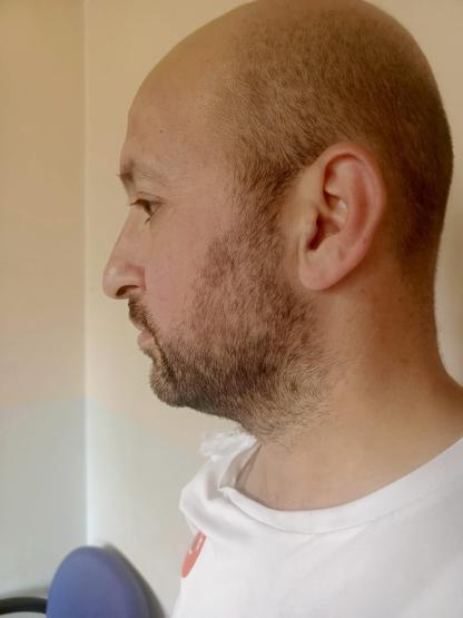 Velayet davasına kan bulaştı Çocuğunu görmeye giden babaya kadınlardan sopalı saldırı: İmdat diye kaçtı