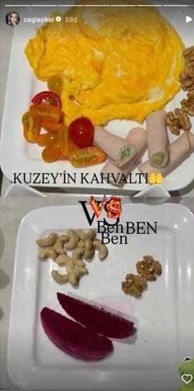 Çağla Şıkel, Gluten Yedikten Sonra Yaşadığı Değişimi Paylaştı: Yanlışlıkla Yedim