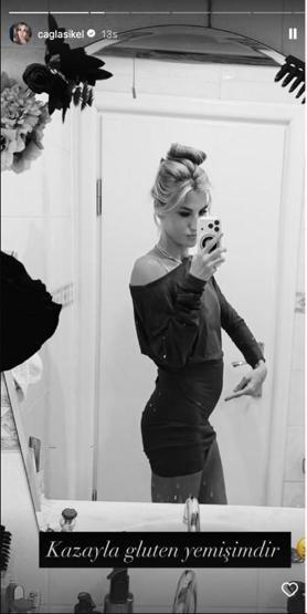 Çağla Şıkel, Gluten Yedikten Sonra Yaşadığı Değişimi Paylaştı: Yanlışlıkla Yedim