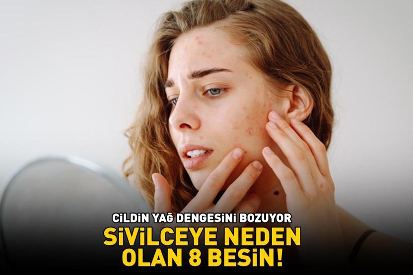 SİVİLCE YAPAN 8 BESİN Cildin yağ dengesini bozuyor, akne ve siyah noktaya neden oluyor