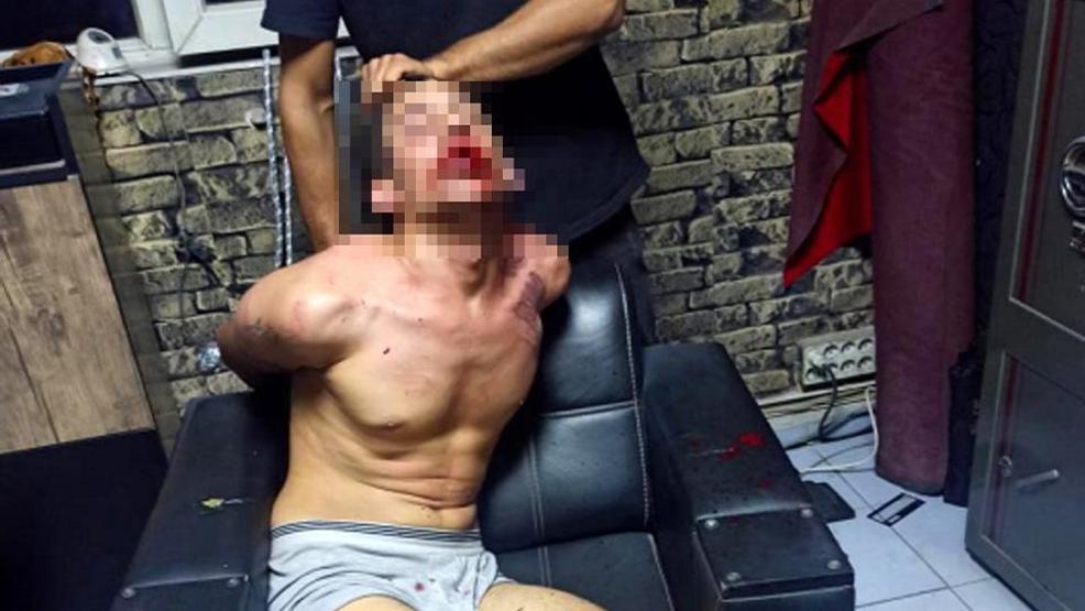 Böcek yedirip, dişlerini kırdılar İşkenceci 4 kişiye istenilen ceza belli oldu