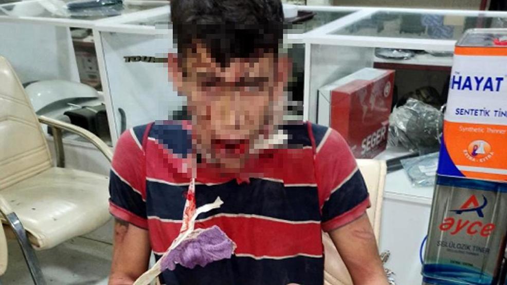 Böcek yedirip, dişlerini kırdılar İşkenceci 4 kişiye istenilen ceza belli oldu