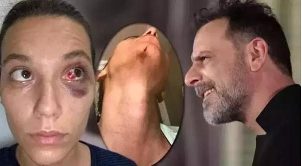 Ozan Güven’e 45 Günlük Hapis Şoku Ünlü Oyuncunun Cezası Kesinleşti