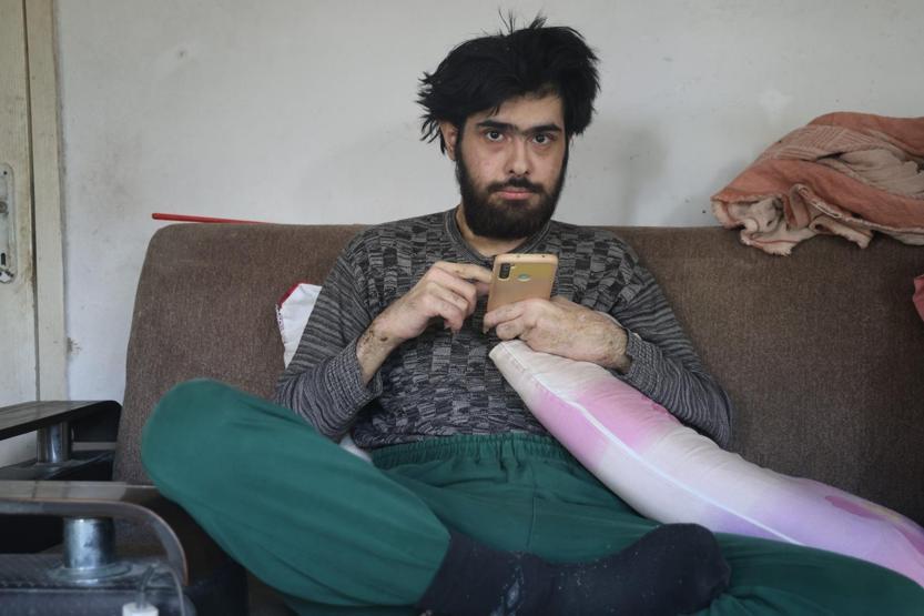 Türkiye ona üzülmüştü Hatayda 3 yıl sonra duş alıp, tıraş olan Barışa teşhis konuldu