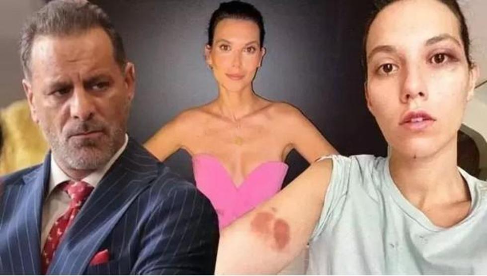 Ozan Güven 5 Yıl Sonra Sessizliğini Bozdu Eski Sevgilisi Deniz Bulutsuz’dan Dikkat Çeken Paylaşım