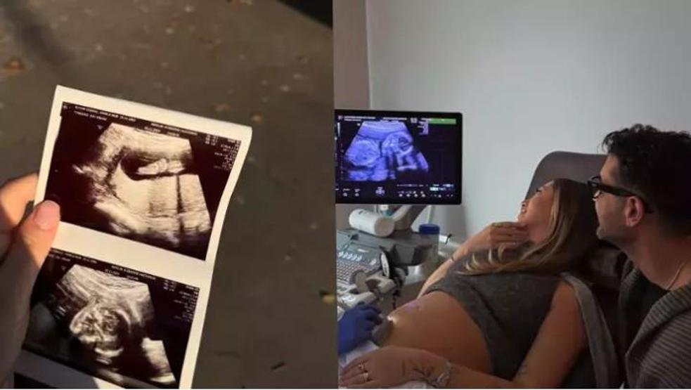 Damla Altun’dan Hamilelik Paylaşımı: 18 Haftalık Bebeğiyle Şakacı Pozlar