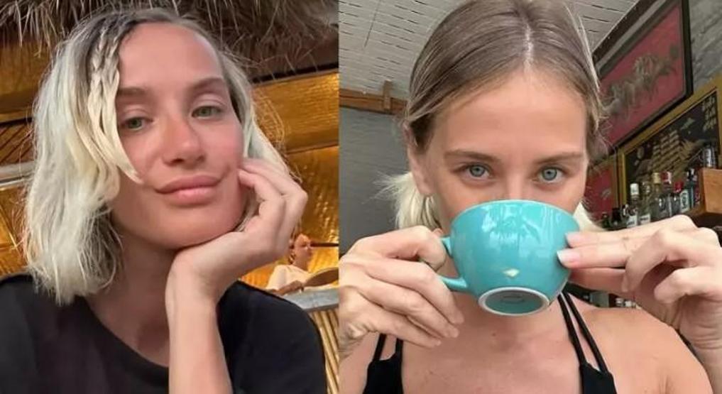 Didem Soydandan Estetik Sorularına Cesur ve Dürüst Yanıt