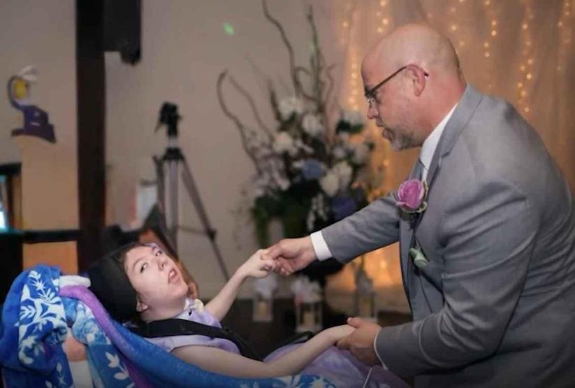 O bir savaşçı Doğuştan beyninin neredeyse tamamı yok: Doktorların 4 yıl ömür biçtiği Alex, 20 yaşında