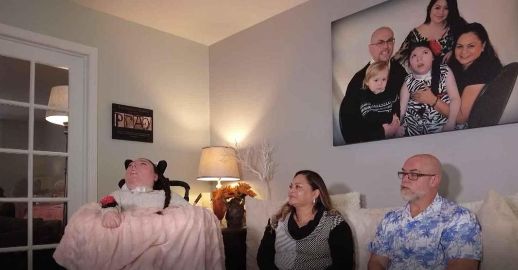 O bir savaşçı Doğuştan beyninin neredeyse tamamı yok: Doktorların 4 yıl ömür biçtiği Alex, 20 yaşında