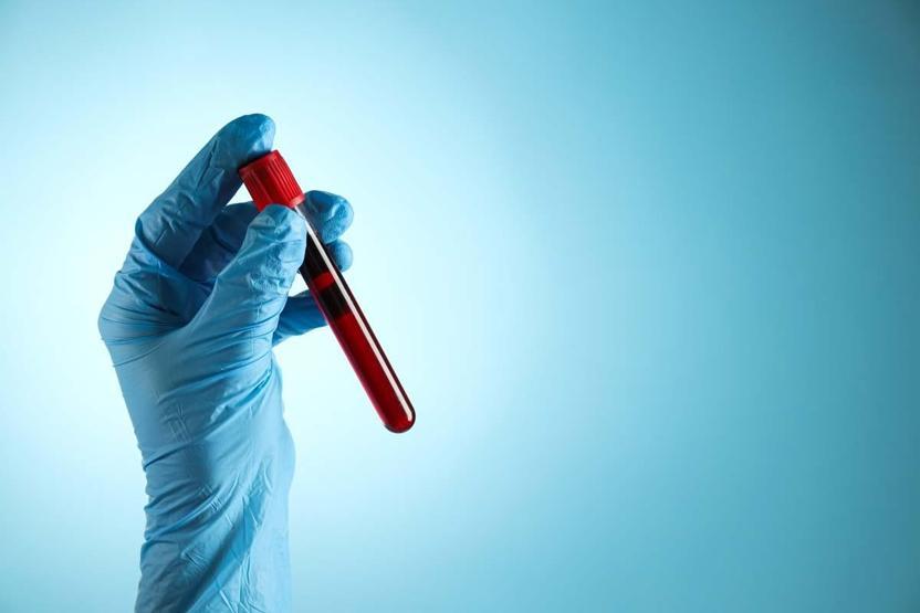Altın Kan: Dünyada Sadece 50 Kişide Var En Nadir Görülen Kan Grubu Rh null Neden Bu Kadar Önemli Rh null Kan Grubunun Kökleri Ne İşte Tüm Detaylar