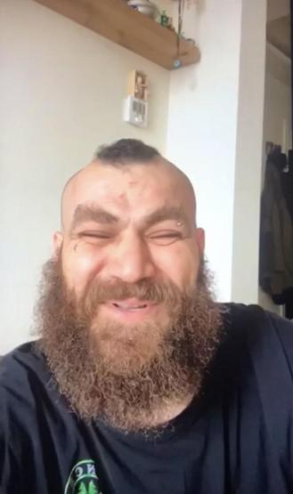 Beyzbol sopasıyla darp Oyuncu Bahadır Ünlüden çalışanına korkunç şiddet: Gözaltına alındı