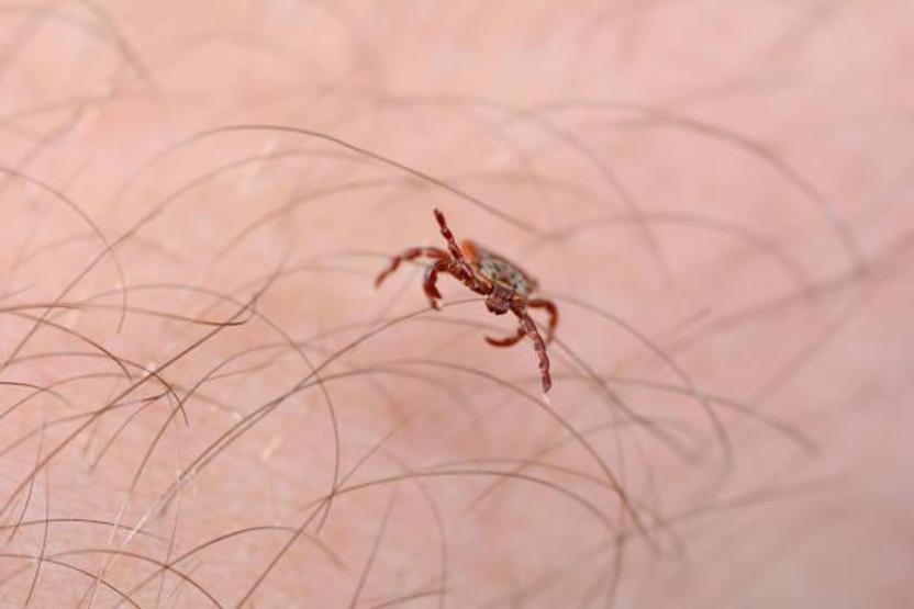 Kene Isırığının Tetiklediği Et Alerjisi İlk Kez Bir Can Aldı