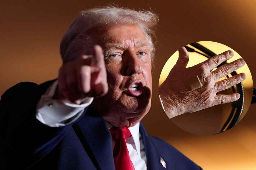 Trump’ın sağlık durumu yine gündemde: Günlerdir sağ elinde yara bandıyla geziyor