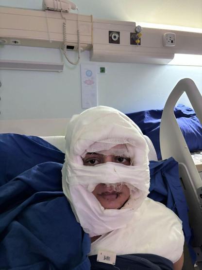 Kadıköyde kadının üzerine yanıcı madde dökmüştü Sanık için istenen ceza belli oldu